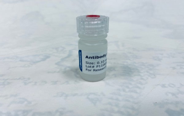 17-Beta-Hydroxysteroid Dehydrogenase Type 14 (HSD17b14) Polyclonal Antibody, Cat#CAU22582