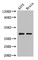 Western Blot; Positive WB detected in: A375 whole cell lysate, Mouse brain tissue; All lanes: SEPT12 antibody at 3.5µg/ml; Secondary; Goat polyclonal to rabbit IgG at 1/50000 dilution; Predicted band size: 41, 36 kDa; Observed band size: 41 kDa