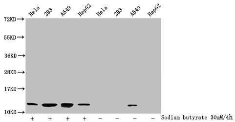 Western Blot, Detected samples: Hela whole cell lysate, 293 whole cell lysate, A549 whole cell lysate, HepG2 whole cell lysate; Untreated (-) or treated (+) with 30mM sodium butyrate for 4h, All lanes: HIST1H4A antibody at 1:2000, Secondary, Goat polyclonal to rabbit IgG at 1/40000 dilution, Predicted band size: 12 kDa, Observed band size: 12 kDa
