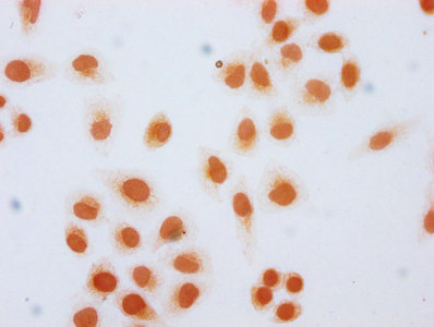 Immunocytochemistry analysis of CAC15607 diluted at 1:20 and staining in Hela cells (treated with 30mM sodium butyrate for 4h) performed on a Leica BondTM system. The cells were fixed in 4% formaldehyde, permeabilized using 0.2% Triton X-100 and blocked with 10% normal goat serum 30min at RT. Then primary antibody (1% BSA) was incubated at 4°C overnight. The primary is detected by a biotinylated secondary antibody and visualized using an HRP conjugated SP system.