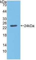 Western Blot; Sample: Recombinant ANGPTL8, Mouse.