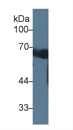 Western Blot; Sample: Mouse Serum; Primary Ab: 1µg/ml Rabbit Anti-Mouse CCDC60 Antibody Second Ab: 0.2µg/mL HRP-Linked Caprine Anti-Rabbit IgG Polyclonal Antibody