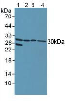 Western Blot; Sample: Lane1: Human Lung Tissue; Lane2: Human Hela Cells; Lane3: Human A549 Cells; Lane4: Bovine Testis Tissue.