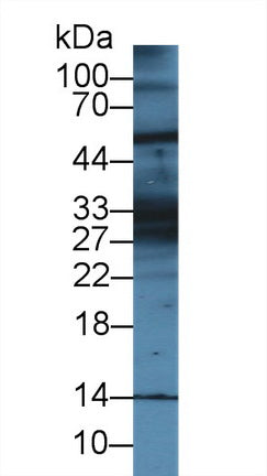 Western Blot; Sample: Mouse Cerebrum lysate; Primary Ab: 1µg/ml Rabbit Anti-Mouse KRT28 Antibody Second Ab: 0.2µg/mL HRP-Linked Caprine Anti-Rabbit IgG Polyclonal Antibody
