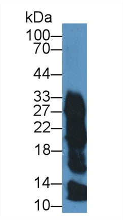 Western Blot; Sample:Hu Saliva; ;Primary Ab: 0.5µg/ml Rabbit Anti-Human ZG16B Antibody;Second Ab: 0.2µg/mL HRP-Linked Caprine Anti-Rabbit IgG Polyclonal Antibody;
