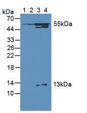 Western Blot; Sample: Lane1: Human Lung Tissue; Lane2: Rat Brain Tissue; Lane3: Rat Heart Tissue; Lane4: Rat Kidney Tissue.