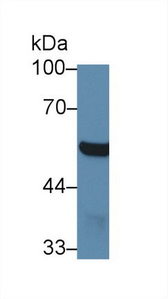 Western Blot; Sample: Mouse Cerebrum lysate; Primary Ab: 1µg/ml Rabbit Anti-Mouse ABAT Antibody Second Ab: 0.2µg/mL HRP-Linked Caprine Anti-Rabbit IgG Polyclonal Antibody
