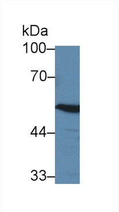 Western Blot; Sample: Rat Cerebrum lysate; Primary Ab: 3µg/ml Rabbit Anti-Human ABAT Antibody Second Ab: 0.2µg/mL HRP-Linked Caprine Anti-Rabbit IgG Polyclonal Antibody