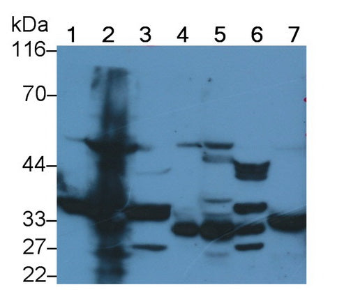 Western Blot; Sample: Lane1: Mouse Heart lysate; Lane2: Mouse Liver lysate; Lane3: Mouse Cerebrum lysate; Lane4: Porcine Heart lysate; Lane5: Porcine Liver lysate; Lane6: Porcine Cerebrum lysate; Lane7: A431 cell lysate; Primary Ab: 2μg/ml Rabbit Anti-Human HMGCL Antibody; Second Ab: 0.2µg/mL HRP-Linked Caprine Anti-Rabbit IgG Polyclonal Antibody;