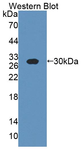 Western Blot; Sample: Recombinant protein.