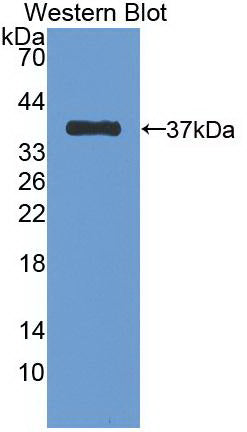 Western Blot; Sample: Recombinant protein.