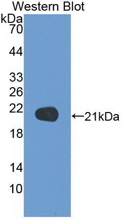 Western Blot; Sample: Recombinant protein.