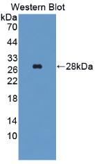 Western Blot;Sample: Recombinant ALT, Human.
