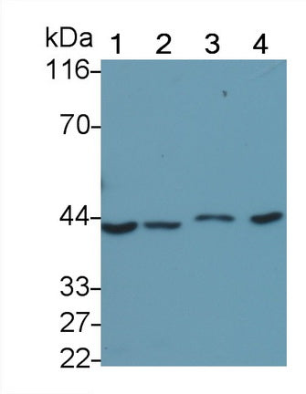 Tumor Protein p53 (P53) Monoclonal Antibody, CAU30693