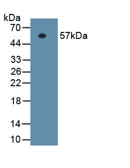 Integrin Beta 1 (ITGb1) Monoclonal Antibody, CAU30701