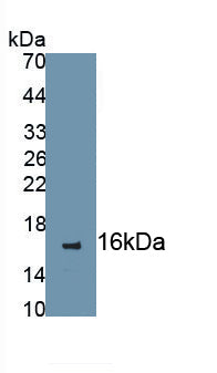 Chemokine C-C-Motif Receptor 7 (CCR7) Monoclonal Antibody, CAU30736