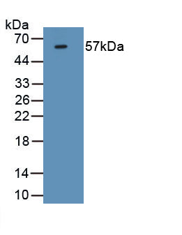 Forkhead Box P3 (FOXP3) Monoclonal Antibody, CAU30751