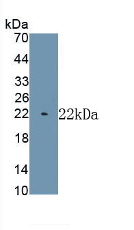 Myosin Heavy Chain 7, Cardiac Muscle, Beta (MYH7) Monoclonal Antibody, CAU30809