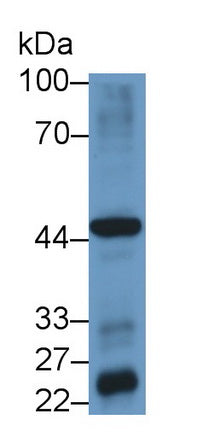 Hedgehog Homolog, Indian (IHH) Polyclonal Antibody, CAU31629