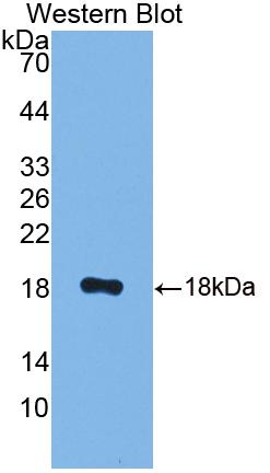 Calcyon Neuron Specific Vesicular Protein (CALY) Polyclonal Antibody, CAU31715