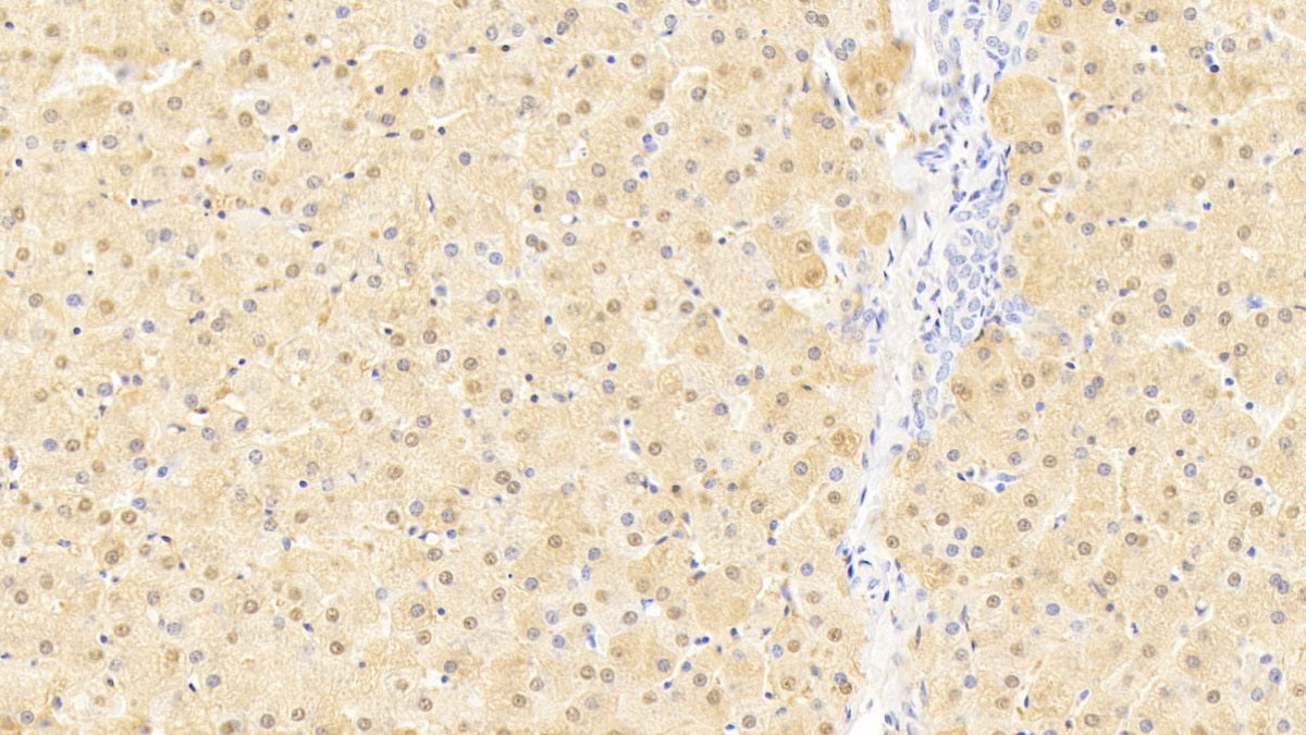 DAB staining on IHC-P; Samples: Human Liver Tissue; Primary Ab: 20μg/ml Rabbit Anti-Human LMTK3 Antibody Second Ab: 2µg/mL HRP-Linked Caprine Anti-Rabbit IgG Polyclonal Antibody