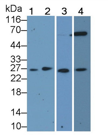 Cyclin Dependent Kinase Inhibitor 1B (CDKN1B) Polyclonal Antibody, CAU31747
