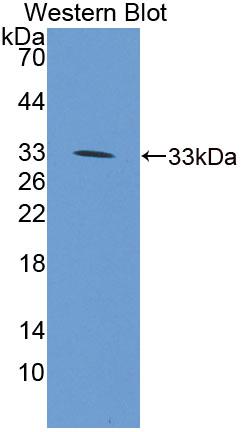 Eukaryotic Translation Initiation Factor 4H (EIF4H) Polyclonal Antibody, CAU31780