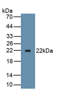 Advillin (AVIL) Polyclonal Antibody, CAU31839