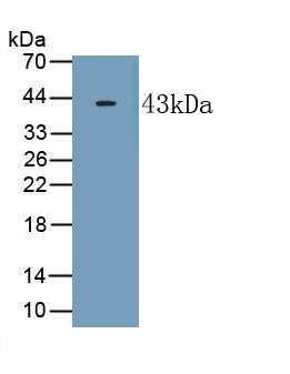Receptor Activity Modifying Protein 2 (RAMP2) Polyclonal Antibody, CAU31864