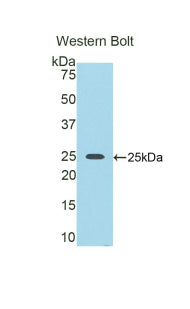 Nexilin (NEXN) Polyclonal Antibody, CAU31867