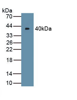 Nodal Homolog (NODAL) Polyclonal Antibody, CAU31883