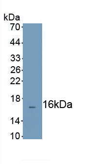 Complement Factor H Related Protein 3 (CFHR3) Polyclonal Antibody, CAU31888
