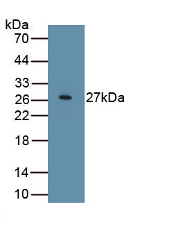 WNT Inhibitory Factor 1 (WIF1) Polyclonal Antibody, CAU31894
