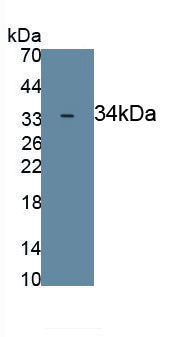 Nuclear Factor, Erythroid Derived 2 Like Protein 2 (NFE2L2) Polyclonal Antibody, CAU31896