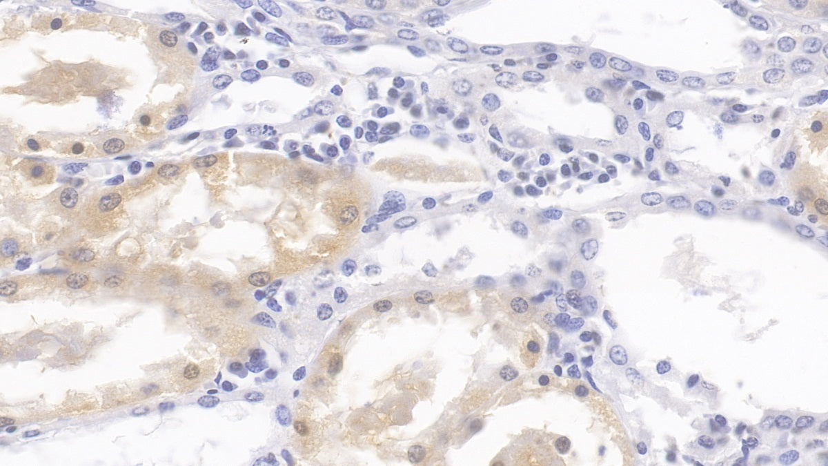 DAB staining on IHC-P; Samples: Human Kidney Tissue; Primary Ab: 30ug/ml Mouse Anti-Human HPD Antibody Second Ab: 2ug/mL HRP-Linked Caprine Anti-Mouse IgG Polyclonal Antibody