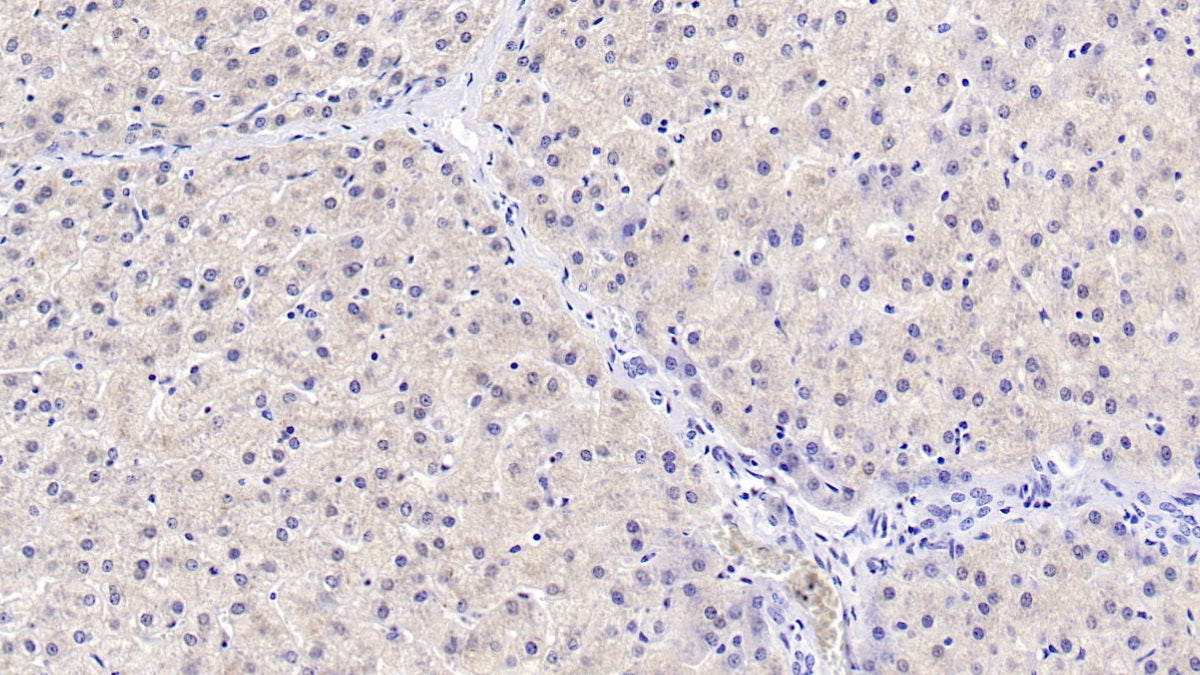 DAB staining on IHC-P; Sample: Human Liver Tissue; Primary Ab: 40ug/ml Mouse Anti-Human HPD Antibody Second Ab: 2ug/mL HRP-Linked Caprine Anti-Mouse IgG Polyclonal Antibody