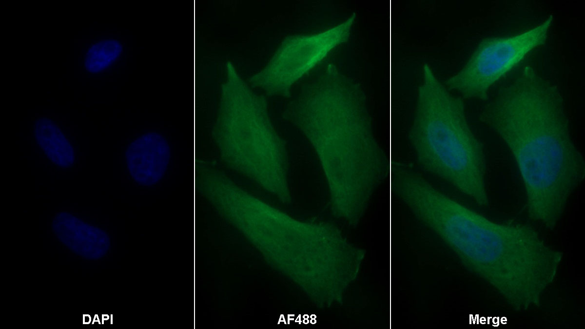 AF488 staining on IF; Sample: HepG2 cell; Primary Ab: 30ug/ml Mouse Anti-Human HPD Antibody; Second Ab: 2ug/ml AF488-Linked Caprine Anti-Mouse IgG Polyclonal Antibody