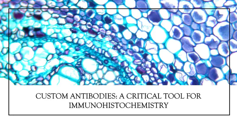 Custom Antibodies: Advancing Discovery and Innovation in Biotechnology