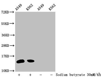 Western Blot, Detected samples: A549 whole cell lysate, K562 whole cell lysate; Untreated (-) or treated (+) with 30mM sodium butyrate for 4h, All lanes: HIST1H2BC antibody at 1:100, Secondary, Goat polyclonal to rabbit IgG at 1/50000 dilution, Predicted band size: 14 kDa, Observed band size: 14 kDa
