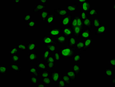 Immunofluorescence staining of Hela cells (treated with 30mM sodium butyrate for 4h) with CAC15570 at 1:10, counter-stained with DAPI. The cells were fixed in 4% formaldehyde, permeabilized using 0.2% Triton X-100 and blocked in 10% normal Goat Serum. The cells were then incubated with the antibody overnight at 4°C. The secondary antibody was Alexa Fluor 488-congugated AffiniPure Goat Anti-Rabbit IgG(H+L).