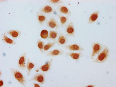 Immunocytochemistry analysis of CAC15614 diluted at 1:5 and staining in Hela cells (treated with 30mM sodium butyrate for 4h) performed on a Leica BondTM system. The cells were fixed in 4% formaldehyde, permeabilized using 0.2% Triton X-100 and blocked with 10% normal goat serum 30min at RT. Then primary antibody (1% BSA) was incubated at 4°C overnight. The primary is detected by a biotinylated secondary antibody and visualized using an HRP conjugated SP system.