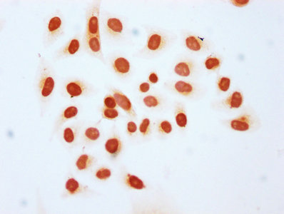 Immunocytochemistry analysis of CAC15615 diluted at 1:10 and staining in Hela cells (treated with 30mM sodium butyrate for 4h) performed on a Leica BondTM system. The cells were fixed in 4% formaldehyde, permeabilized using 0.2% Triton X-100 and blocked with 10% normal goat serum 30min at RT. Then primary antibody (1% BSA) was incubated at 4°C overnight. The primary is detected by a biotinylated secondary antibody and visualized using an HRP conjugated SP system.