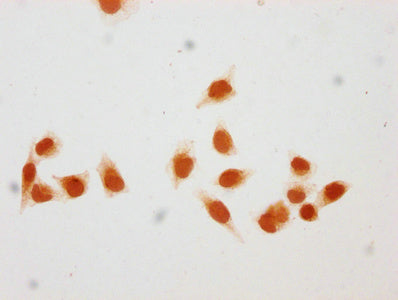 Immunocytochemistry analysis of CAC15673 diluted at 1:50 and staining in Hela cells (treated with 30mM sodium butyrate for 4h) performed on a Leica BondTM system. The cells were fixed in 4% formaldehyde, permeabilized using 0.2% Triton X-100 and blocked with 10% normal goat serum 30min at RT. Then primary antibody (1% BSA) was incubated at 4°C overnight. The primary is detected by a biotinylated secondary antibody and visualized using an HRP conjugated SP system.