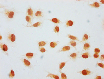 Immunocytochemistry analysis of CAC15674 diluted at 1:50 and staining in Hela cells (treated with 30mM sodium butyrate for 4h) performed on a Leica BondTM system. The cells were fixed in 4% formaldehyde, permeabilized using 0.2% Triton X-100 and blocked with 10% normal goat serum 30min at RT. Then primary antibody (1% BSA) was incubated at 4°C overnight. The primary is detected by a biotinylated secondary antibody and visualized using an HRP conjugated SP system.