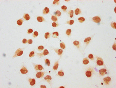 Immunocytochemistry analysis of CAC15675 diluted at 1:40 and staining in Hela cells (treated with 30mM sodium butyrate for 4h) performed on a Leica BondTM system. The cells were fixed in 4% formaldehyde, permeabilized using 0.2% Triton X-100 and blocked with 10% normal goat serum 30min at RT. Then primary antibody (1% BSA) was incubated at 4°C overnight. The primary is detected by a biotinylated secondary antibody and visualized using an HRP conjugated SP system.