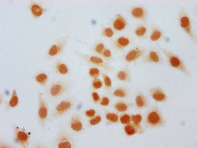 Immunocytochemistry analysis of CAC15678 diluted at 1:40 and staining in Hela cells (treated with 30mM sodium butyrate for 4h) performed on a Leica BondTM system. The cells were fixed in 4% formaldehyde, permeabilized using 0.2% Triton X-100 and blocked with 10% normal goat serum 30min at RT. Then primary antibody (1% BSA) was incubated at 4°C overnight. The primary is detected by a biotinylated secondary antibody and visualized using an HRP conjugated SP system.