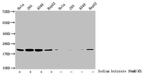 Western Blot, Detected samples: Hela whole cell lysate, 293 whole cell lysate, A549 whole cell lysate, HepG2 whole cell lysate; Untreated (-) or treated (+) with 30mM sodium butyrate for 4h, All lanes: HIST1H1C antibody at 3.5ug/ml, Secondary, Goat polyclonal to rabbit IgG at 1/50000 dilution, Predicted band size: 22 kDa, Observed band size: 22 kDa