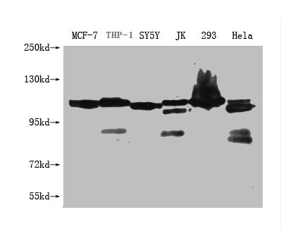 Western Blot Positive WB detected in: USP6 antibody at 1:1000 Lane 1: MCF-7 whole cell lysate Lane 2: THP-1 whole cell lysate Lane 3: SH-SY5Y whole cell lysate Lane 4: Jurkat whole cell lysate Lane 5: HEK293 whole cell lysate Lane 6: Hela whole cell lysateSecondary Goat polyclonal to Mouse IgG at 1/20000 dilution Predicted band size: 89, 122, 159 KDa Observed band size: 89, 122, 159 KDa Exposure time: 1min