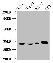 Western Blot, Positive WB detected in: Hela whole cell lysate, HepG2 whole cell lysate, MCF-7 whole cell lysate, PC-3 whole cell lysate, All lanes: AGBL2 antibody at 1:1000, Secondary, Goat polyclonal to mouse IgG at 1/50000 dilution, Predicted band size: 32, 49, 104 KDa, Observed band size: 32 KDa, Exposure time：5min