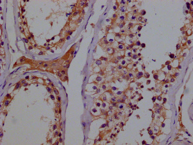 IHC image of CAC15938 diluted at 1:100 and staining in paraffin-embedded human testes tissue performed on a Leica BondTM system. After dewaxing and hydration, antigen retrieval was mediated by high pressure in a citrate buffer (pH 6.0). Section was blocked with 10% normal goat serum 30min at RT. Then primary antibody (1% BSA) was incubated at 4°C overnight. The primary is detected by a biotinylated secondary antibody and visualized using an HRP conjugated SP system.